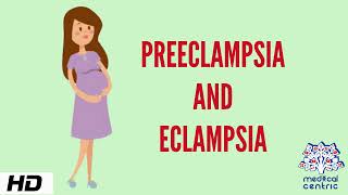 Preeclampsia and Eclampsia Causes Signs and Symptoms Diagnosis and Treatment [upl. by Lipp]