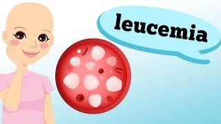 LEUCEMIA O QUE É O QUE OCORRE [upl. by Ayardna675]