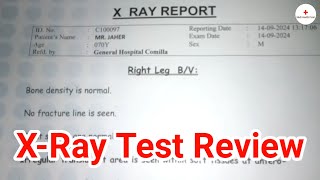 XRay test review  Investigation  Health tips bangla  Medi Health Point [upl. by Cran805]