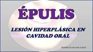 ÉPULIS  Lesión Hiperplásica en Cavidad Oral [upl. by Enrobso]