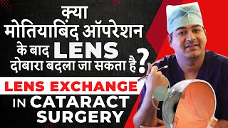 Lens Exchange After Cataract Surgery  क्या मोतियाबिंद ऑपरेशन के बाद लेंस दोबारा बदला जा सकता है [upl. by Greer]