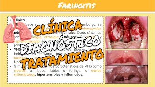 ⚕️🩺FARINGITISFARINGOAMIGDALITIS y HERPANGINA SíntomasTratamiento [upl. by Nagn]