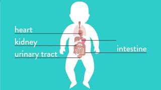 Conditions Explained Esophageal Atresia [upl. by Jacy]