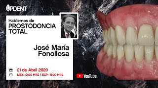 Zonas de influencia protesica en prostodoncia total [upl. by Ahsieker419]