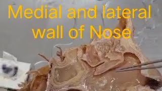 sagittal section of head neck and face nose dissection hnf anatomy [upl. by Aleyam]