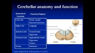 Pediatric Posterior Fossa Tumours and Cerebellar Mutism Kelly Bullivant [upl. by Wain632]