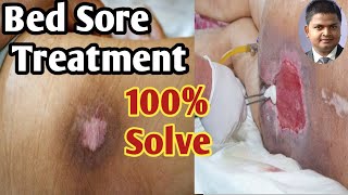 Bed Sore Treatment Step by Step [upl. by Blair]