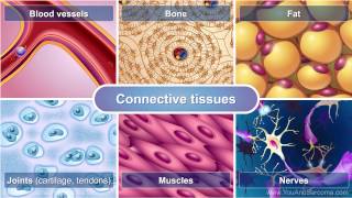 Understanding Soft Tissue Sarcoma [upl. by Retsev]