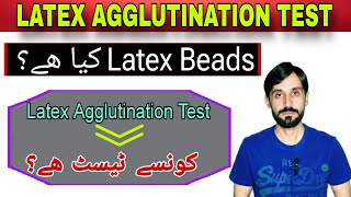 Latex Agglutination Test [upl. by Annalla866]