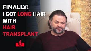 Can I Grow Long Hair After Hair Transplant  Featured Patient Review [upl. by Ettelegna434]