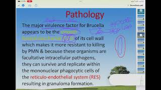 Lecture 1 Brucellosis  paediatric  اطفال  طب القادسية [upl. by Yerahcaz]