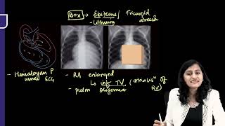 RADIOLOGY RAPID REVISION PART 02 FMGE INICET NEET PG [upl. by Tab]