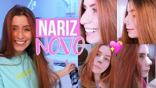 VLOG MINHA RINOPLASTIA CIRURGIA NO NARIZ [upl. by Bryna]