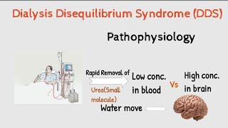 What is Dialysis Disequilibrium syndrome DDS  Hemodialysis Complications and management [upl. by Dhiren]