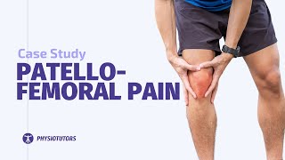 Patellofemoral Pain Case Study [upl. by Yenobe930]