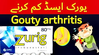 zurig 40 mg  zurig 80 mg tablet uses  zurig tablet uses in urdu  uric acid treatment  zurig 40mg [upl. by Atikal]