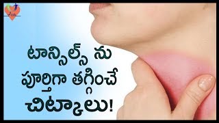 టాన్సిల్స్ ను పూర్తిగా తగ్గించే చిట్కాలు   Best Natural Home Remedies To Cure Tonsillitis  Arogya [upl. by Nitsyrc418]