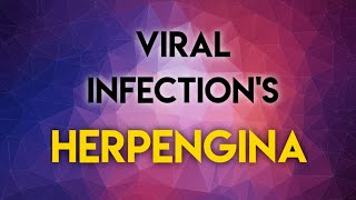 VIRAL INFECTIONS  HERPENGINA [upl. by Anail]