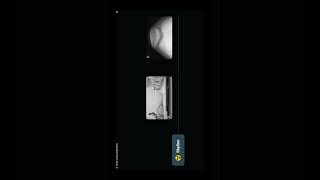 Radiographic Positioning of the Knee  8  Positions radiology quiz learningradiology شرح [upl. by Notgnillew62]