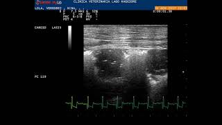 Lung ultrasound 10 MHz linear probe showing subpleural nodular lesions which are the typical probe [upl. by Iliram]