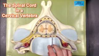 Spinal Cord Transection in Cervical Vertebra [upl. by Hannahsohs695]