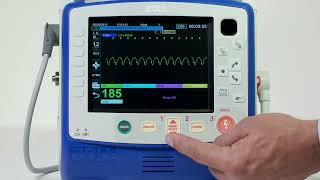 X Series® Synchronized Cardioversion English [upl. by Edaw]