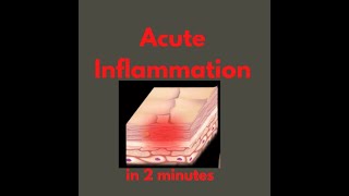 Acute inflammation in 2 mins [upl. by Eenhat755]