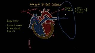 Atriyal Septal Defekt Fen Bilimleri Sağlık ve Tıp [upl. by Ellenej69]