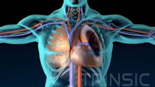 Pulmonary Embolism Medical Animation [upl. by Dareece]