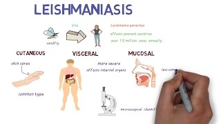 What is Leishmaniasis An introduction and overview [upl. by Mojgan125]