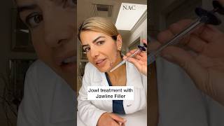 Jowl Treatment with Jawline Filler drbitafarrell fillers beauty [upl. by Eric]