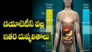 Other ill effects of diabetes Telugu  Health Xpress [upl. by Murdoch]