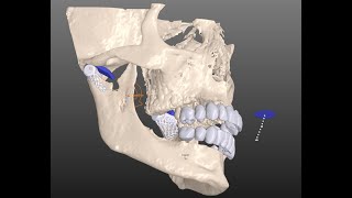 B4D Articulator Module [upl. by Anegue]