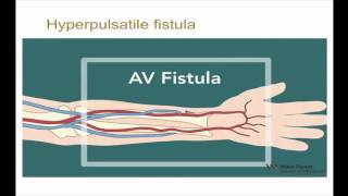 10minute Rounds Outflow Stenosis and the Arteriovenous Fistula [upl. by Yerfej]