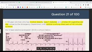 MRCP PART TWO PAST PAPERS OCT 2019 2 [upl. by Tigram]