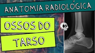 Anatomia radiológica RX dos MEMBROS INFERIORES Parte 15  OSSOS DO TARSO [upl. by Bracci]