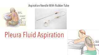 Aspiration Needle With Rubber Tube  Pleural Fluid Aspiration  Sites of Aspiration  Indications [upl. by Akirdnwahs267]