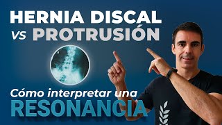 ★ Hernia discal VS Protrusión discal Cómo interpretar una resonancia  ✅ 10 EJERCICIOS [upl. by Vedette]