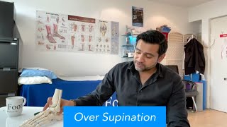 Over Supination and Under Pronation  Abid Hussain Podiatrist [upl. by Sakovich]