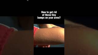 How to treat those tiny bumps on your arms skincare skincareadvice bodycare skincareroutine [upl. by Nirrok]