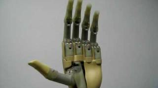 Drew Hittenberger amp Assoc i Limb Prosthetic Handavi [upl. by Quintie]