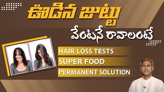 Solution For Hair Fall  Causes For Hair Loss  Manthena Official [upl. by Lleda]