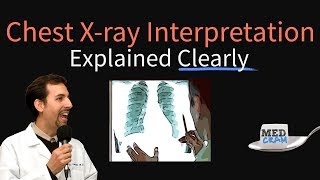 Chest XRay Interpretation Explained Clearly  How to read a CXR [upl. by Kreegar349]