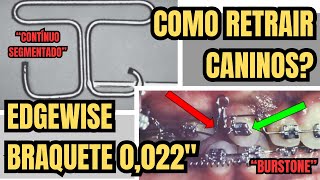 Como fechar espaços de exodontias retraindo caninos com o aparelho Edgewie Braquete 0022  Aula 203 [upl. by Mosera]