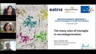 Neuroscience Webinar  Role of microglia in health and disease [upl. by Eggleston]