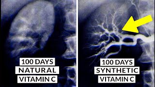 We Finally Know What Type Of Vitamin C Is Best [upl. by Yelir]