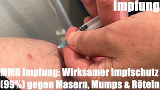 MMR Impfung Wirksamer Impfschutz 99 gegen Masern Mumps amp Röteln [upl. by Hidie]