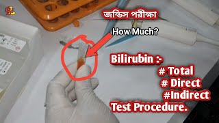 Bilirubin Total Direct amp Indirect Test Procedure [upl. by Thomasa]