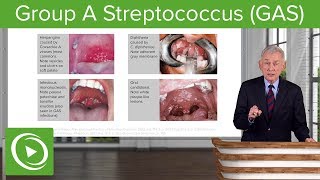 Group A Streptococcus GAS – Infectious Diseases  Lecturio [upl. by Rowney762]