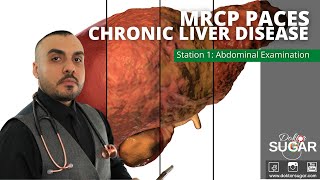 MRCP PACES  Station 1  Chronic Liver Disease [upl. by Lali400]